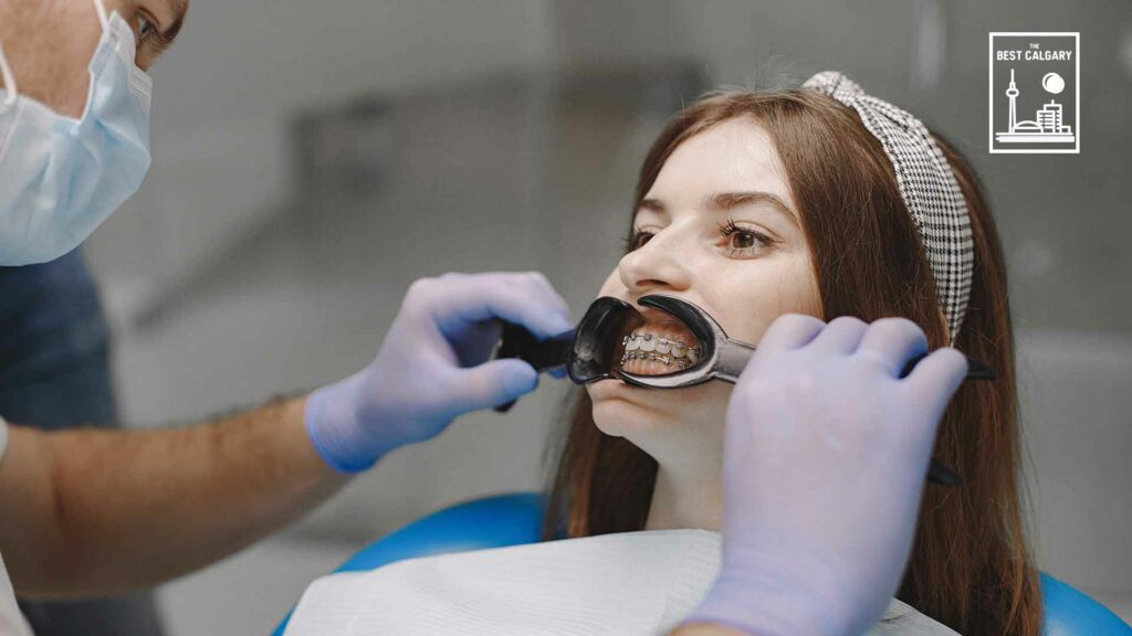Best Braces in Calgary