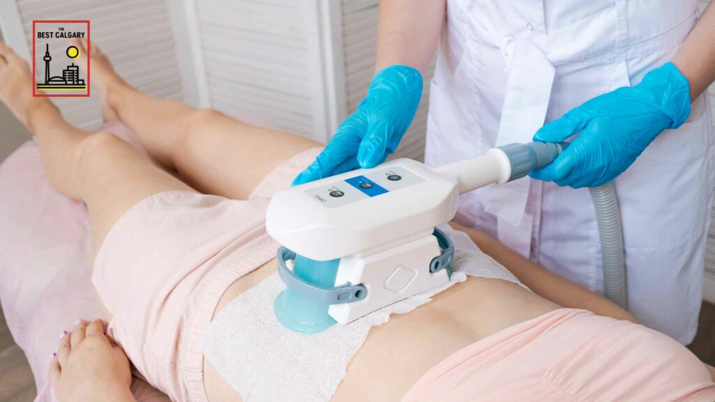 Best Coolsculpting in Calgary