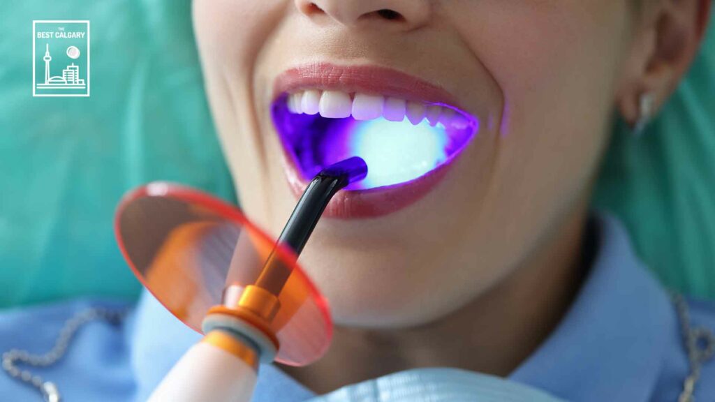 5 Ways to Avoid Cavities