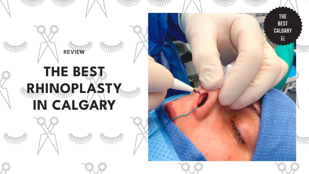 best-rhinoplasty-calgary-banner