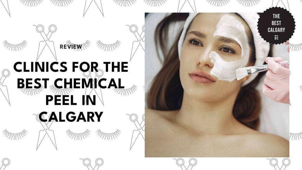 Best Chemical Peel in Calgary