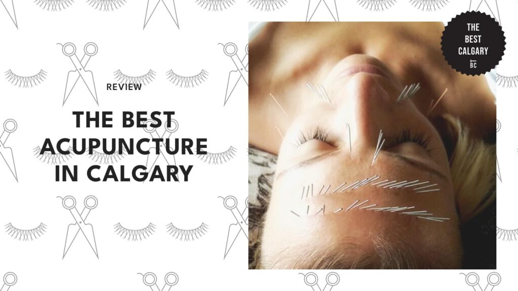 acupuncture-calgary---top-image