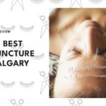 acupuncture-calgary---top-image