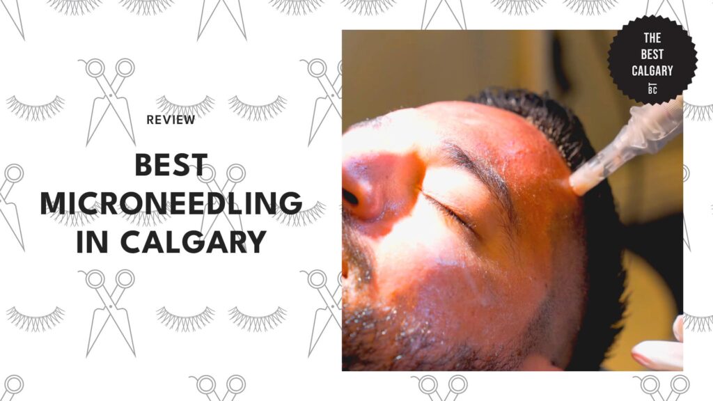top-microneedling-calgary-banner