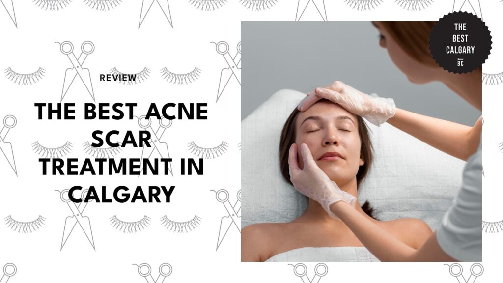 best-acne-scar-treatment-calgary